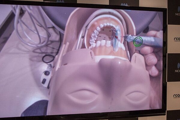 MR技術を医療に応用　世界初の歯科治療MRシミュレーションシステムの意義としくみ