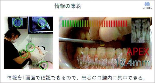 MR技術を医療に応用　世界初の歯科治療MRシミュレーションシステムの意義としくみ