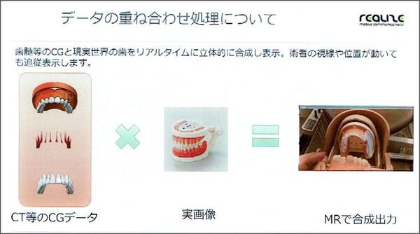MR技術を医療に応用　世界初の歯科治療MRシミュレーションシステムの意義としくみ