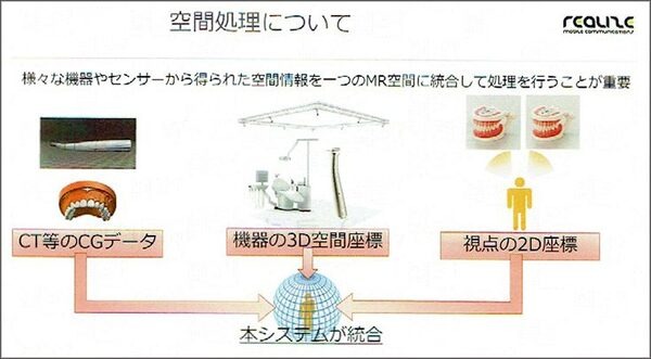 MR技術を医療に応用　世界初の歯科治療MRシミュレーションシステムの意義としくみ