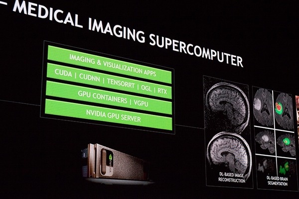 AIが医療画像分野でも革新を起こせるか？NVIDIAが掲げる最新の「プロジェクト・クララ」(Project Clara)」とは