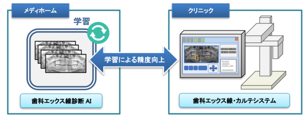 診断速度は医師の6千倍　虫歯など歯の病気を発見する診断AIが開発