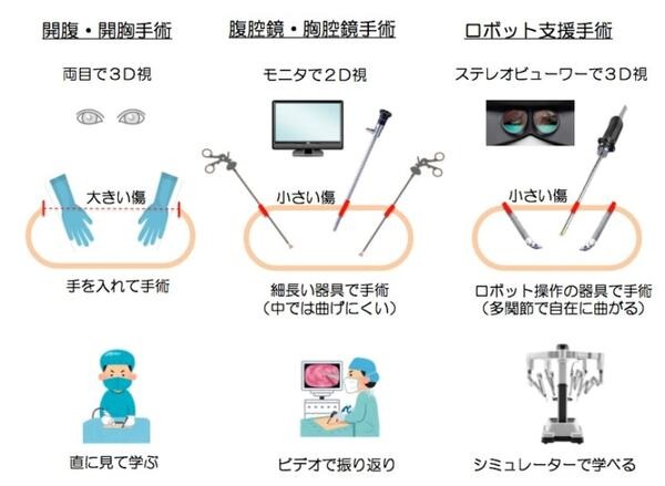 ロボット支援手術が急増！「ダビンチ」とはどんなロボットか? 特長と課題、ロボット手術をとりまく日本の状況を探る(ダビンチ特集 /前編)