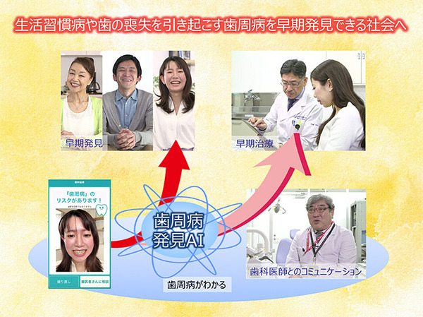 スマホで撮影するだけでAIが歯周病を発見する　東北大学とNTTドコモが共同研究を開始、2022年を目処に実用化を目指す