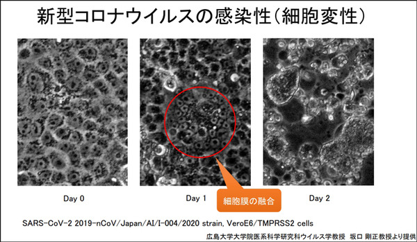 【速報】広島大学病院「紫外線Care222は新型コロナウイルスの不活化に有効」世界に先駆けて発表　ウシオ電機の製品で実証