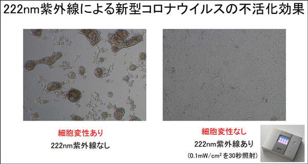 【速報】広島大学病院「紫外線Care222は新型コロナウイルスの不活化に有効」世界に先駆けて発表　ウシオ電機の製品で実証