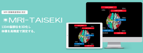 認知症を予測するAI技術を開発するためフューチャーと日本テクトシステムズが業務提携 2025年の認知症高齢者は730万人超を予測