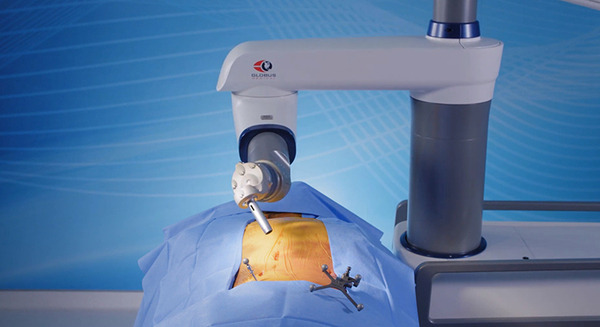 【手術支援ロボット】脊椎手術用ロボットアームとナビゲーションプラットフォーム「Excelsius GPS」日本市場へ導入