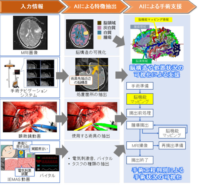 【国内初】5Gとクラウドで大容量の手術データをAIが解析する実証実験へ　ドコモ(5G)、はこだて未来大(AI)、東京女子医科大(SCOT)