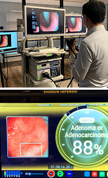 【5G×AI】ソフトバンクが遠隔医療の実証実験　内視鏡の検査映像を5Gで伝送、画像診断をAIが支援　地域間の医療格差の解消めざす