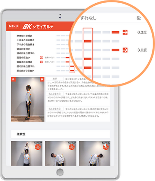 東大発スタートアップのSapeet、AI姿勢分析システム「シセイカルテ」が グンゼの提供する医療×スポーツの取り組みで活躍