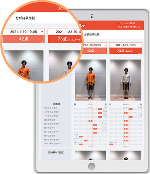 東大発スタートアップのSapeet、AI姿勢分析システム「シセイカルテ」が グンゼの提供する医療×スポーツの取り組みで活躍