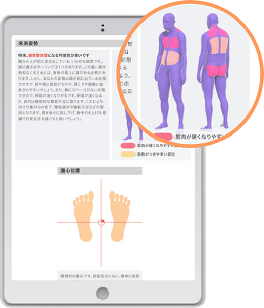 東大発スタートアップのSapeet、AI姿勢分析システム「シセイカルテ」が グンゼの提供する医療×スポーツの取り組みで活躍