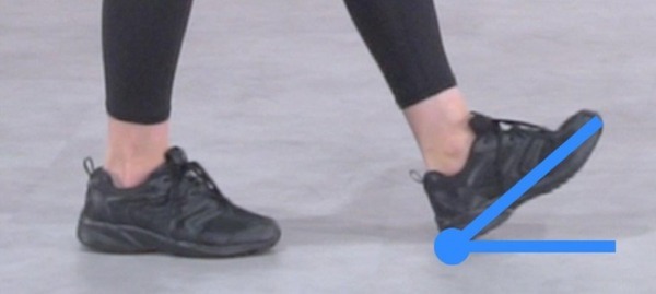 治療用インソールは扁平足治療に効果あり？ NECと帝京大学が「歩容」を見える化するIoT研究で連携