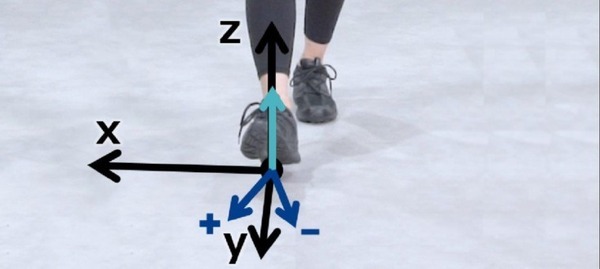 治療用インソールは扁平足治療に効果あり？ NECと帝京大学が「歩容」を見える化するIoT研究で連携