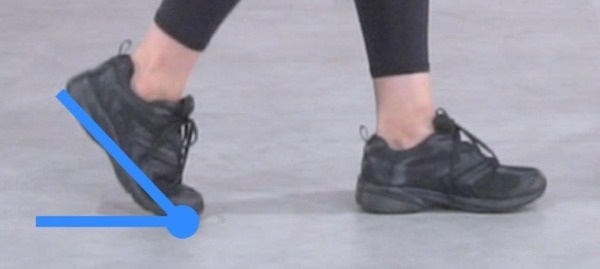 治療用インソールは扁平足治療に効果あり？ NECと帝京大学が「歩容」を見える化するIoT研究で連携