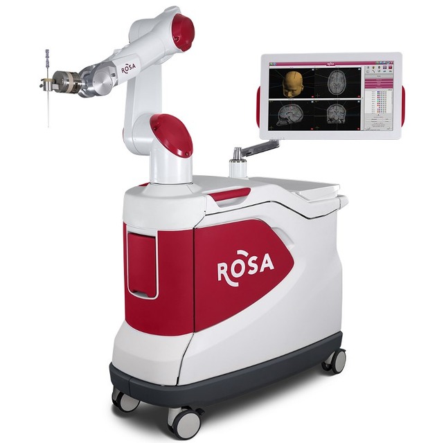 【国内初症例】脳神経外科のロボット支援手術を順天堂が実施　ジンマーバイオメット「ROSA One」で頭蓋内深部電極植込術