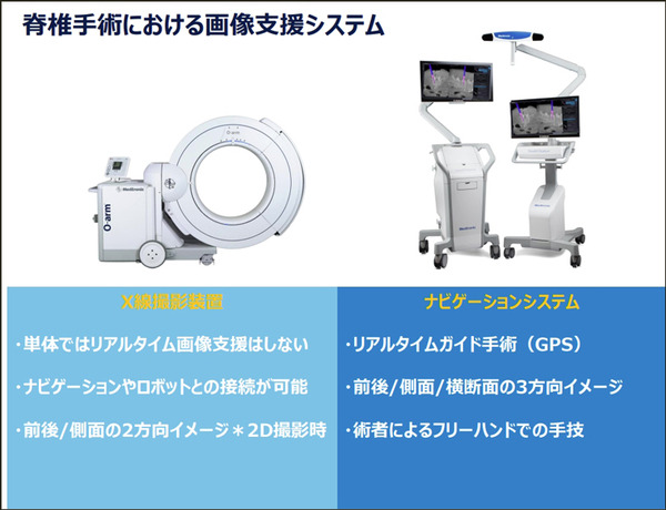 【速報】脊椎固定術の手術支援ロボットシステム「Mazor X」のしくみと特徴を日本メドトロニックが公開