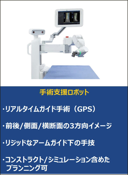 【速報】脊椎固定術の手術支援ロボットシステム「Mazor X」のしくみと特徴を日本メドトロニックが公開