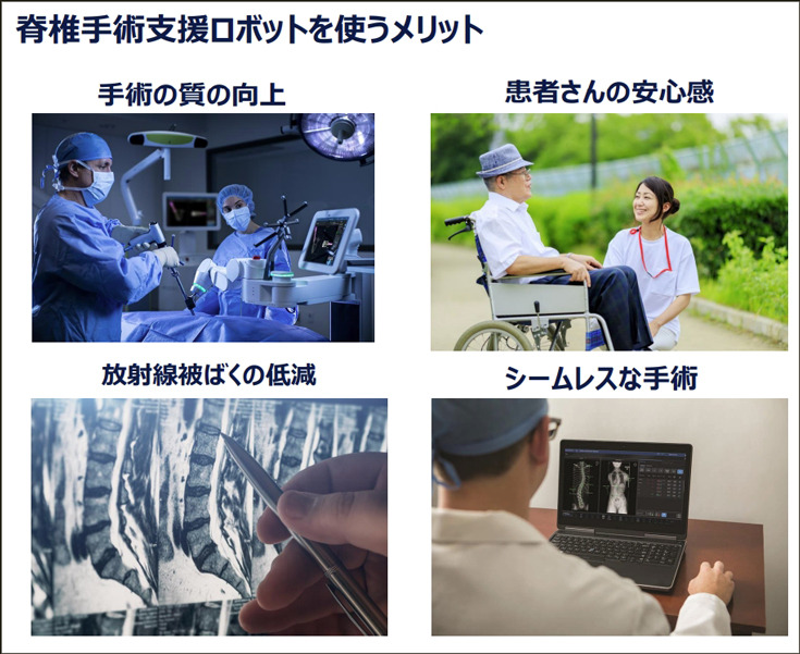 【速報】脊椎固定術の手術支援ロボットシステム「Mazor X」のしくみと特徴を日本メドトロニックが公開