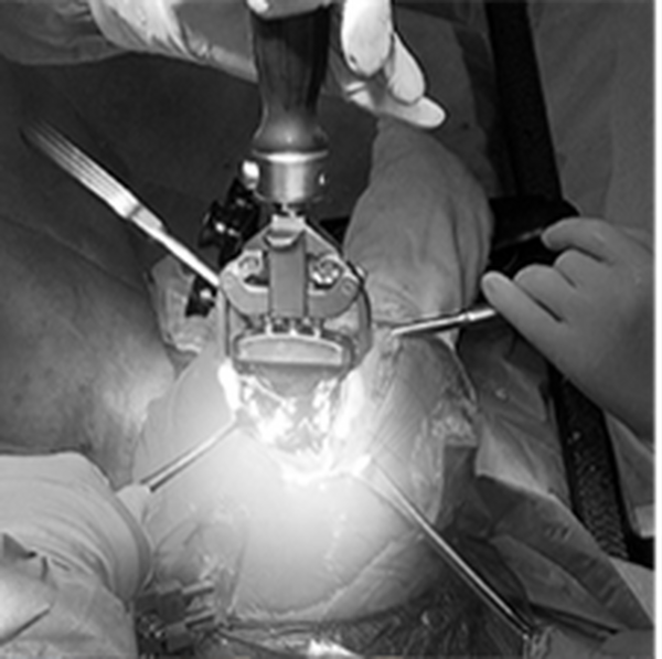 人工関節のロボティックアーム手術に密着 テレビ大阪「生きがいをつなげ！ロボット×医療 最前線」12月21日に放送