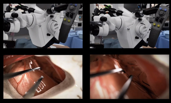 NVIDIA「医療の新時代を支えるAIとデジタルツイン」の現状を語る　AI活用/手術支援ロボット/デジタルツイン/大規模言語モデルと創薬