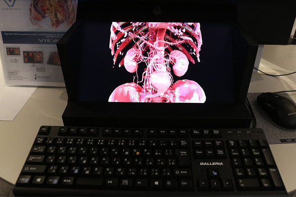 メドトロニックが最新の手術支援ロボットシステム「Hugo」を公開　X線設備付き研修トラックやMR技術など5つの最新医療ICT体験会