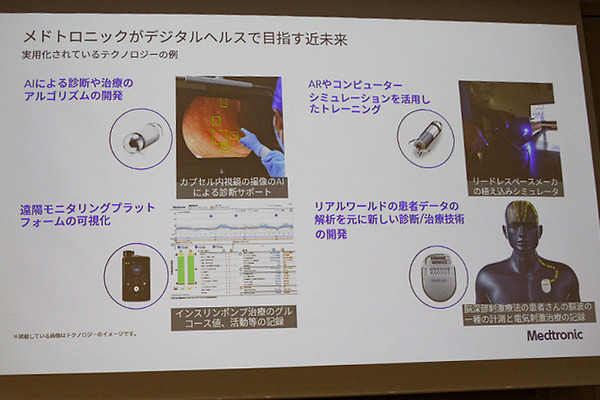 メドトロニックが最新の手術支援ロボットシステム「Hugo」を公開　X線設備付き研修トラックやMR技術など5つの最新医療ICT体験会