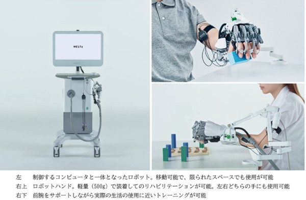 麻痺した手を思い通りに動かすAIロボットを開発　脳卒中後の上肢運動機能を改善　順天堂大学医学部とメルティンが共同で