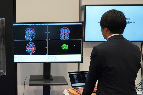 「5年後、認知機能に影響する脳の海馬はどれだけ萎縮する?」ドコモが将来の脳画像を予測する生成AIを開発 海馬の体積変化を可視化