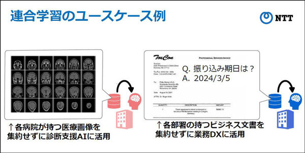 NTT【世界初】連合学習においてAIモデルに異常や悪意がある場合でも高精度に学習できるモメンタムスクリーニング技術手法を発表