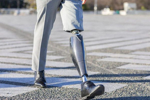 パワード義足「Bio Leg」が米国で医療保険適用承認を取得　モーター駆動で階段の昇降や立ち上がりもスムーズにアシスト