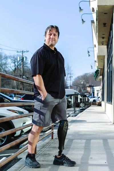 パワード義足「Bio Leg」が米国で医療保険適用承認を取得　モーター駆動で階段の昇降や立ち上がりもスムーズにアシスト