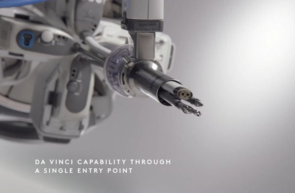 上尾中央総合病院「ダビンチSP」シングルポート手術支援ロボット導入から1年、手術の実績を公表　低侵襲手術を多領域で実施