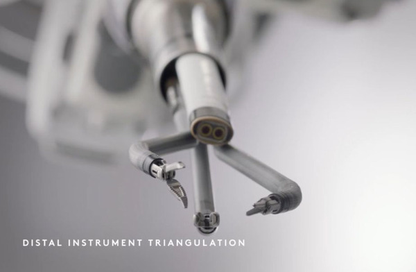 上尾中央総合病院「ダビンチSP」シングルポート手術支援ロボット導入から1年、手術の実績を公表　低侵襲手術を多領域で実施