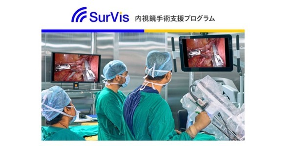 NVIDIAのGPU搭載「内視鏡手術支援プログラムSurVis-Hys」が医療機器承認を取得　Jmeesと国立がん研究センター東病院が共同開発