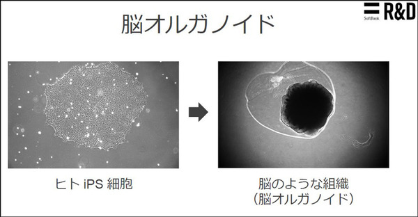 ソフトバンクと東京大、脳オルガノイドで「人工脳細胞のプロセッサ」を共同研究、世界初の成果を発表 「脳細胞が次世代コンピュータになる」