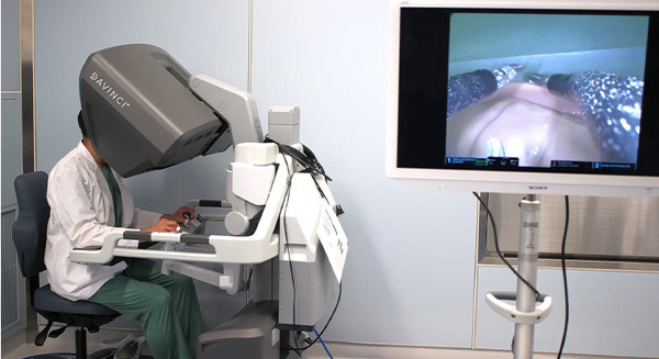 【日本初】大阪けいさつ病院が1つの傷口だけの「単孔式ロボット支援手術」を実施　最新機種「ダビンチSP」で患者負担軽減へ