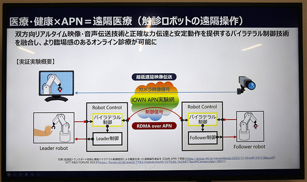 NTT東日本「触覚と映像を使ったオンライン診療」デモを公開　現場の看護士と遠隔の医師がIOWNでリアル触診　ユカイ工学が協力