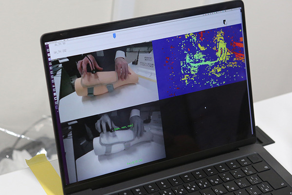 NTT東日本「触覚と映像を使ったオンライン診療」デモを公開　現場の看護士と遠隔の医師がIOWNでリアル触診　ユカイ工学が協力