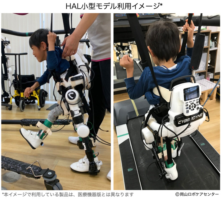 医療用ＨＡＬ小型モデルが医療機器承認を取得　子どもなど身長150cm以下でもサイバニクス治療が可能に