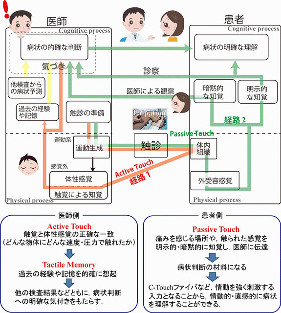 世界初「遠隔触診システム」を公開デモ　名古屋大学と豊田合成が3/1にシンガポールと結び遠隔触診　オンライン配信も