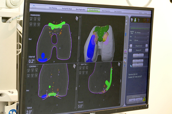 日本ストライカーが本社を拡張移転、ショールーム付きに　人工関節置換術用ロボット「Mako」訓練施設も