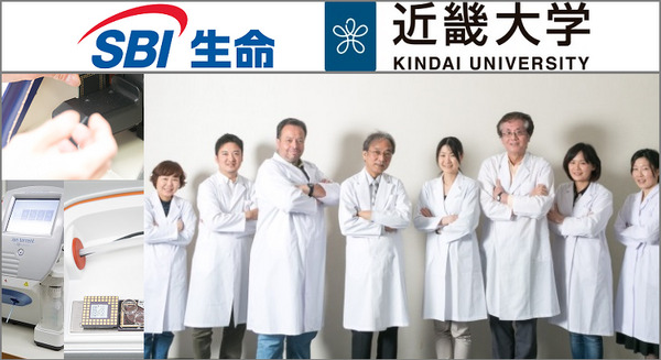 SBI生命、AIを活用した高額検査「がん遺伝子パネル検査」の保険商品化に向け先行研究へ　近畿大学医学部附属病院にて今夏より 画像