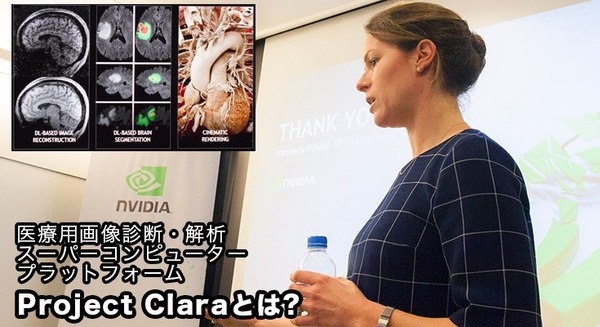AIが医療画像分野でも革新を起こせるか？NVIDIAが掲げる最新の「プロジェクト・クララ」(Project Clara)」とは 画像