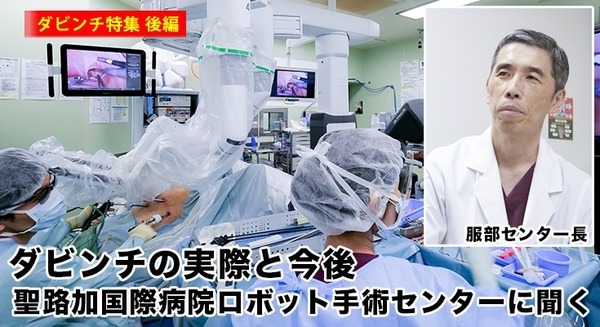 ダビンチのロボット手術の症例1,000件超、聖路加国際病院ロボット手術センターに聞く「ダビンチの実際と今後」(ダビンチ特集 /後編) 画像
