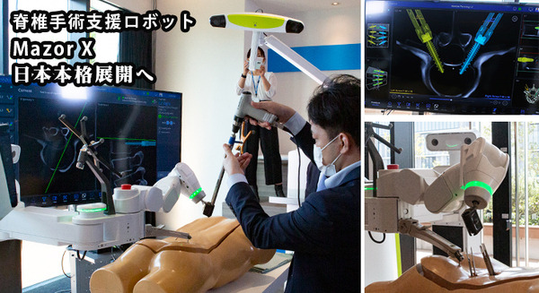 【速報】脊椎固定術の手術支援ロボットシステム「Mazor X」のしくみと特徴を日本メドトロニックが公開 画像