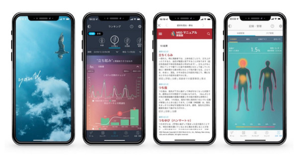 自分のデータで体調を整えるAIアプリ「you’d」医学事典「MSDマニュアル」と連携 不調症状を検知して解説ページへと案内 画像
