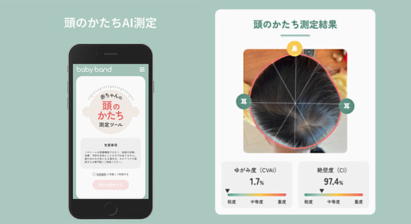 スマホで撮影して赤ちゃんの頭のゆがみ度をAIが測定・可視化する「頭のかたちAI測定」をリリース 画像