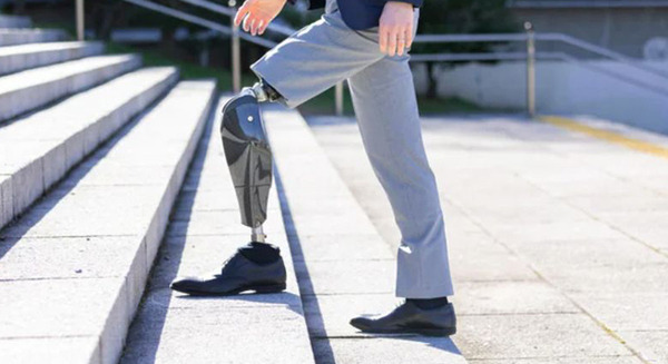 パワード義足「Bio Leg」が米国で医療保険適用承認を取得　モーター駆動で階段の昇降や立ち上がりもスムーズにアシスト 画像